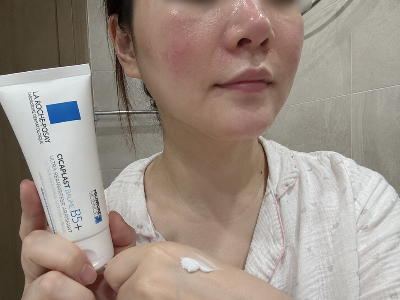 피부과 레이저 시술 후 볼에 발생한 붉은 기와 부작용 증상을 진정시키기 위해 집 욕실에서 라로슈포제 시카플라스트 밤 B5 플러스 재생 크림을 바르는 실제 후기 사진
