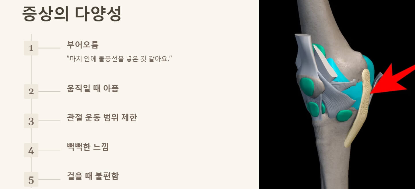 무릎에 물이 차는 증상