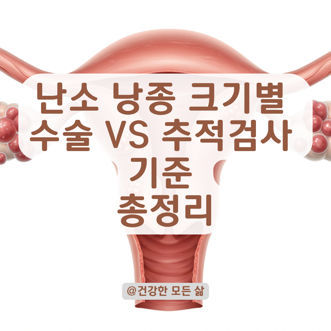 난소 낭종 크기와 구조로 본 수술 또는 추적검사 필요 여부 총정리.