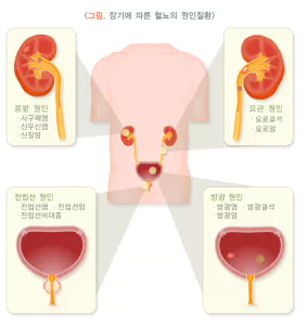 소변거품-사진3