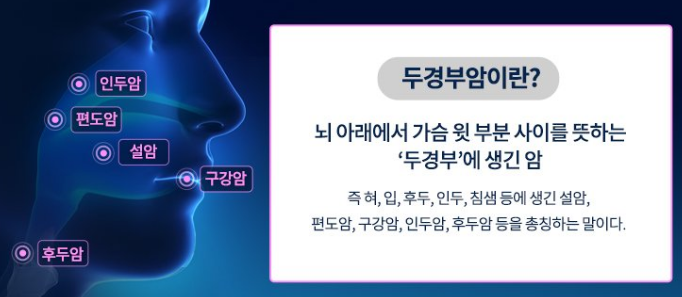 두경부암 증상, 원인, 치료방법