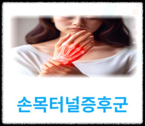 손목이 저리고 아프다면? 손목터널증후군 생활관리법