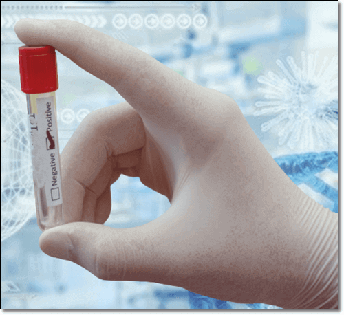 이상지질혈증 원인