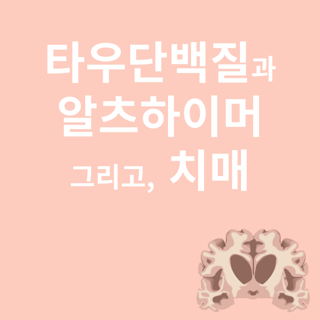 알츠하이머와 관련된 이미지