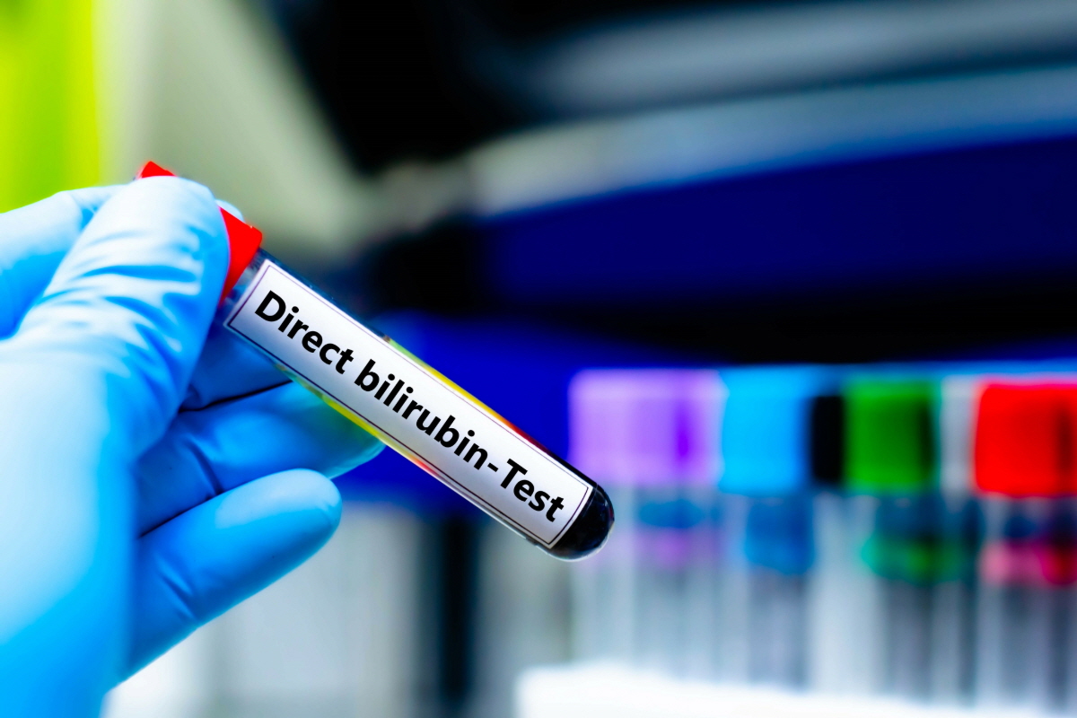 간 수치 낮추는 방법