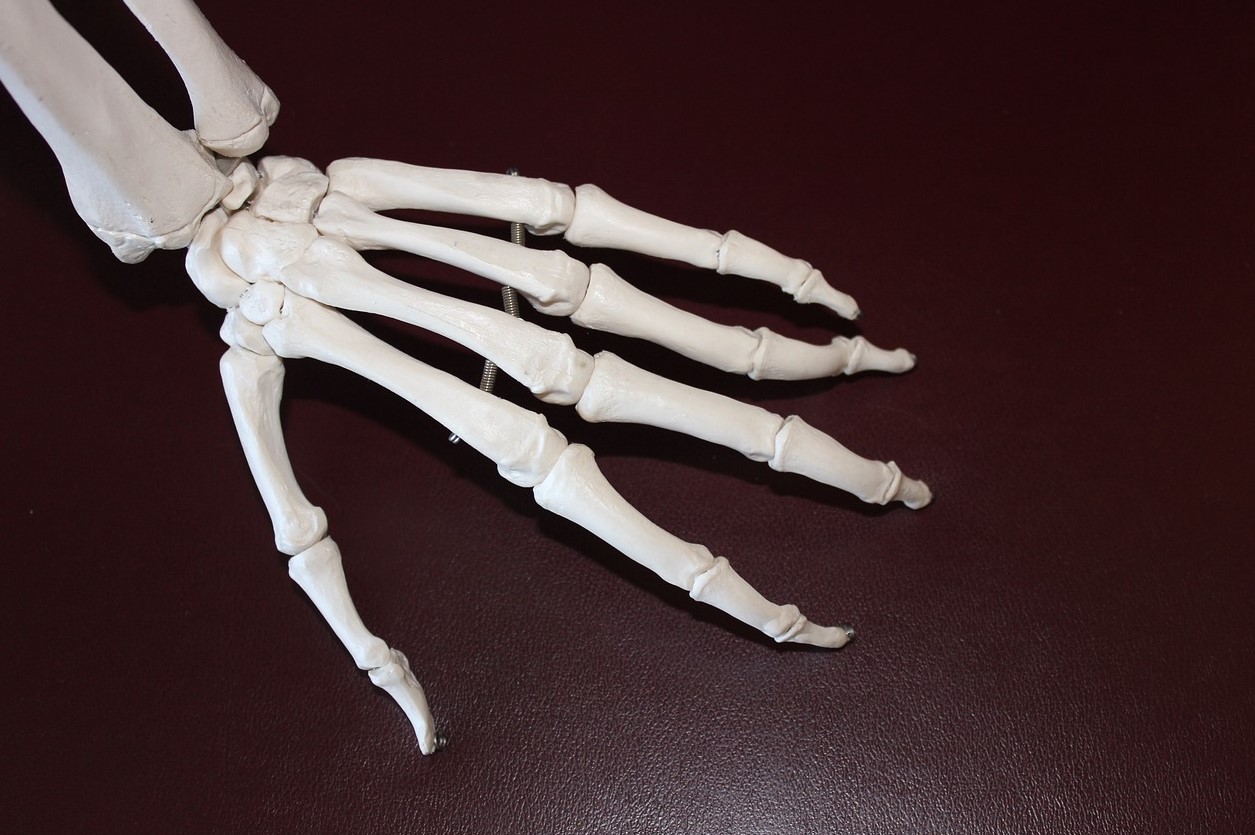 손가락-퇴행성-관절염의-증상