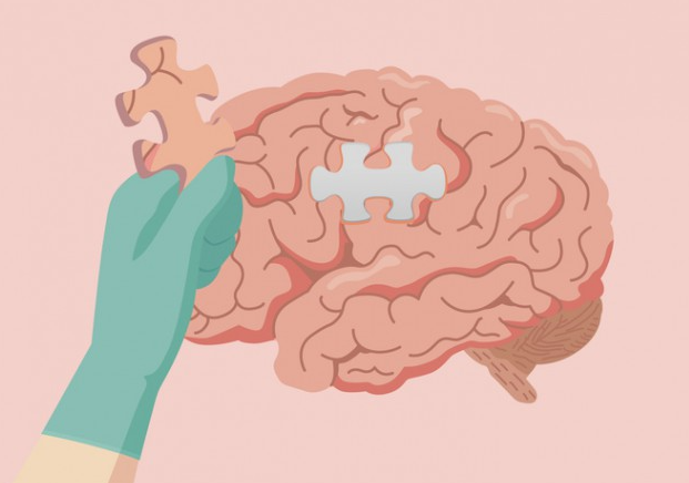 알츠하이머·파킨슨·혈관성 치매 차이점 총정리 + 증상 체크리스트