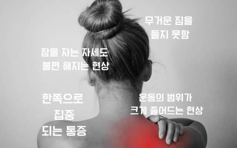 오십견의 특징 적인증상