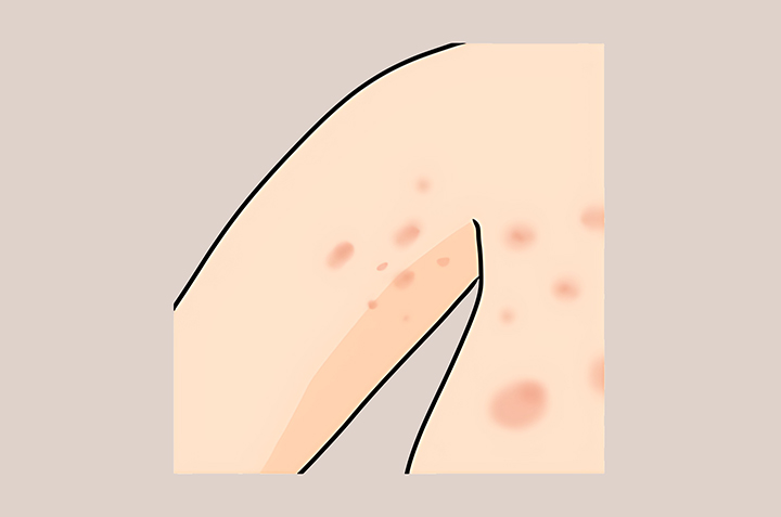 커지는-상처의-크기