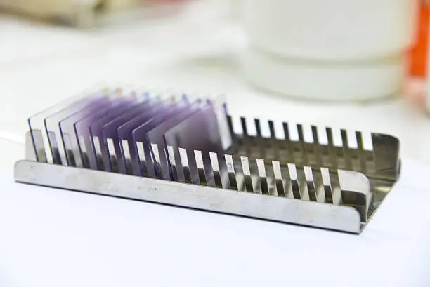 유리기판 관련주 수혜주