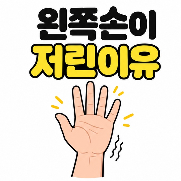 왼쪽손이 저린이유 제목 아래 손바닥과 손목 주변에 감각 변화를 나타내는 짧은 선을 표시한 대표 이미지