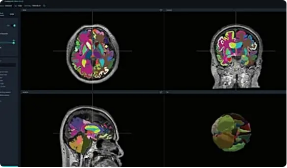 뷰노-치매진단-의료AI-미FDA승인-소개
