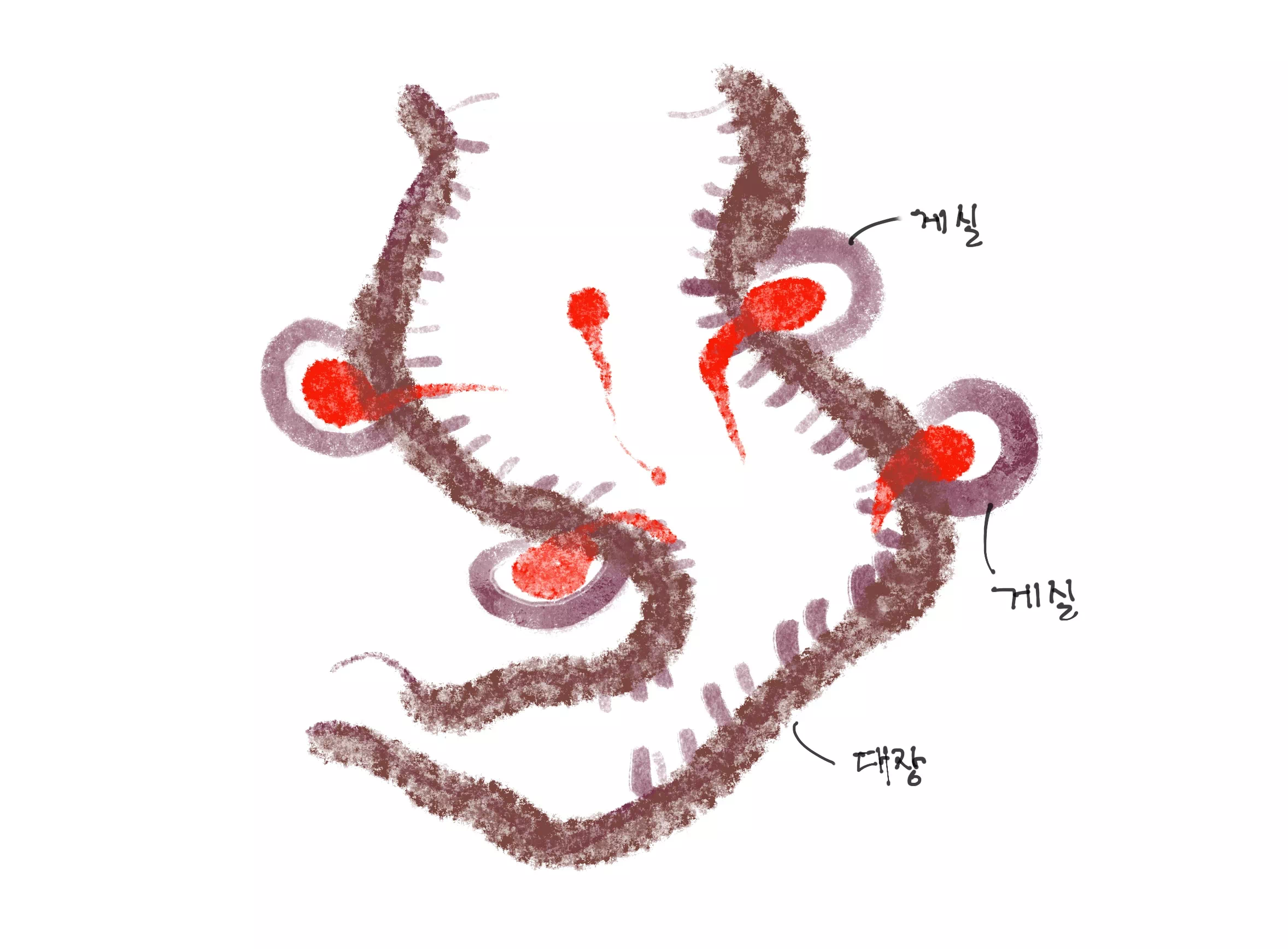 게실염-이미지