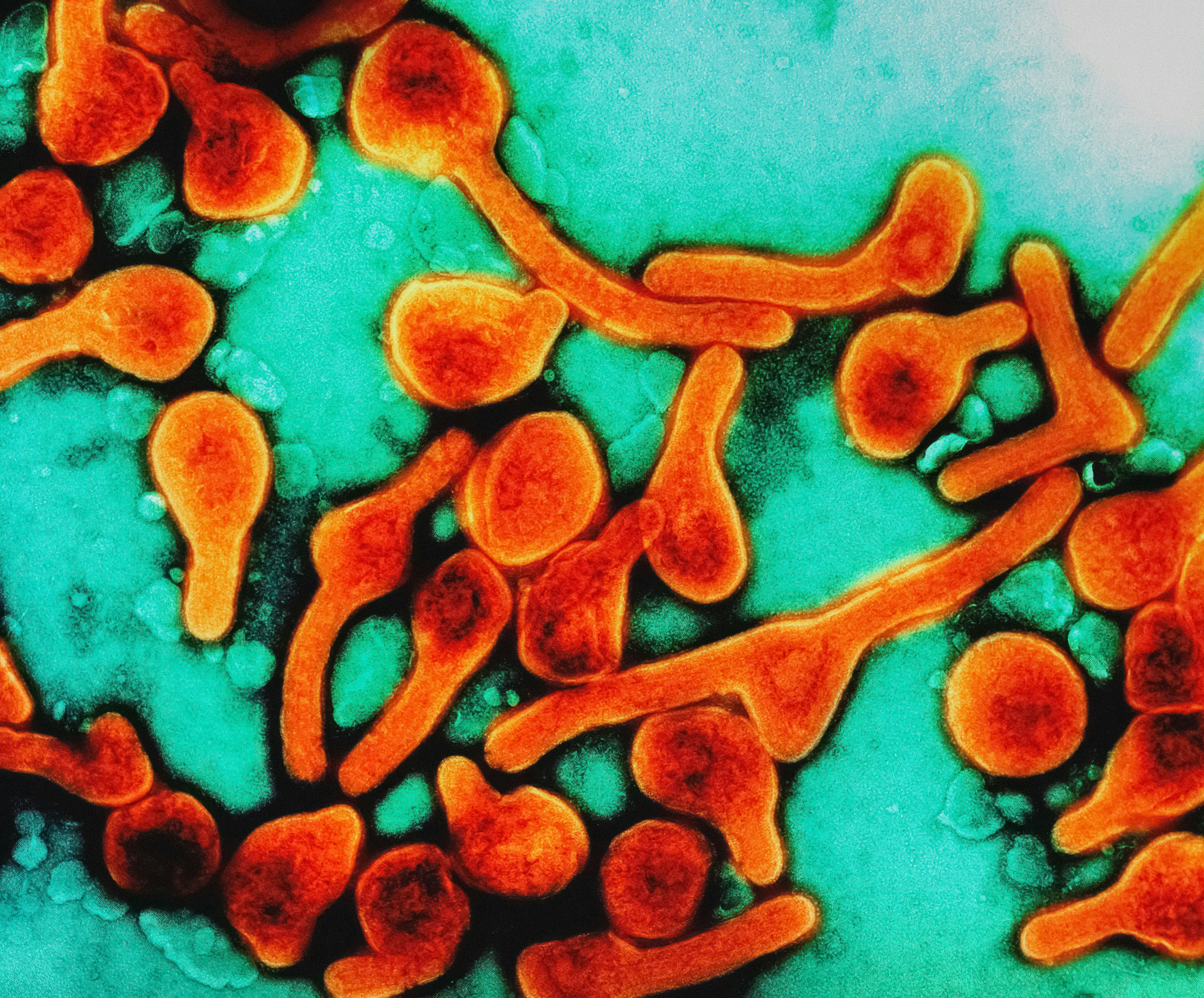 마버그열 바이러스 이미지