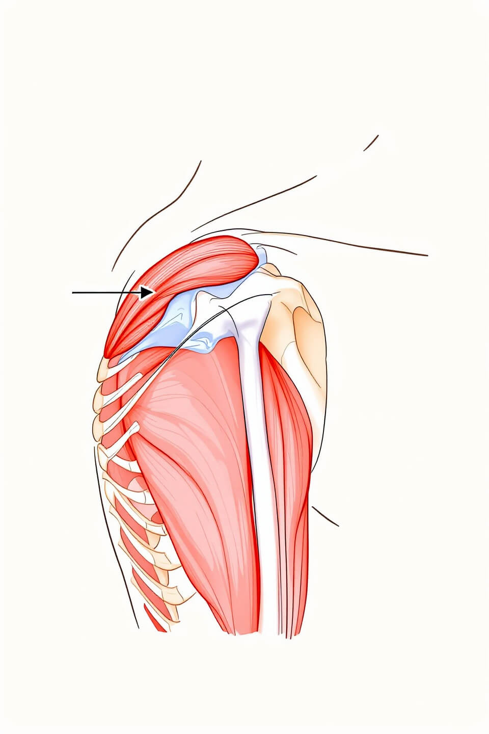 어깨통증과 관련된 사진입니다.