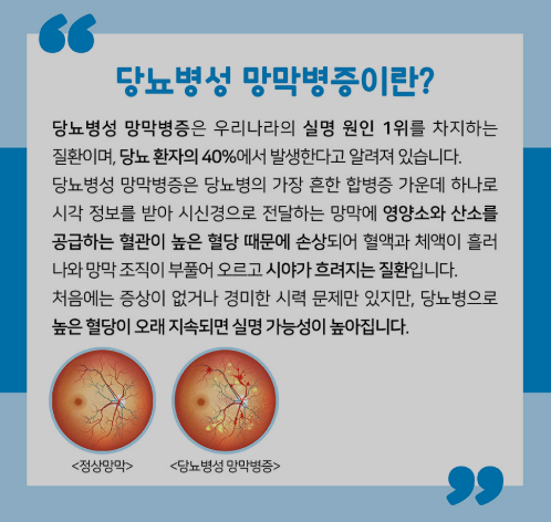 당뇨 정상수치