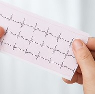 부정맥 치료방법