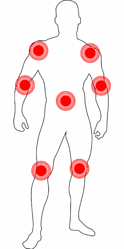 전신 그림에 어깨, 팔꿈치, 허리, 무릎 등 관절염이 발생할 수 있는 부위를 붉게 표시를 한 이미지 사진