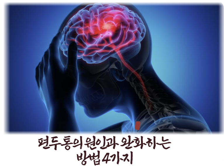 편두통의 원인과 완화하는 방법 4가지