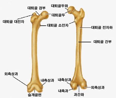 대퇴부 골절