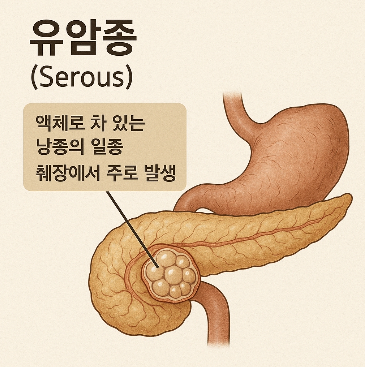유암종 관련 자료 사진