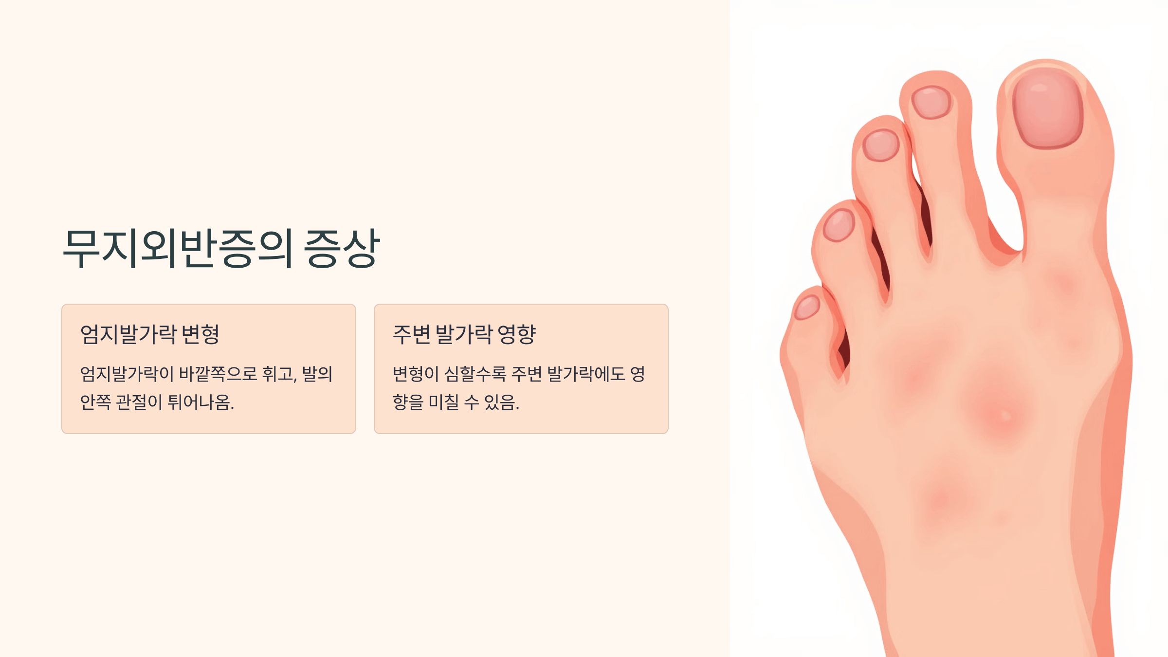 무지외반증과 관련된 사진입니다.