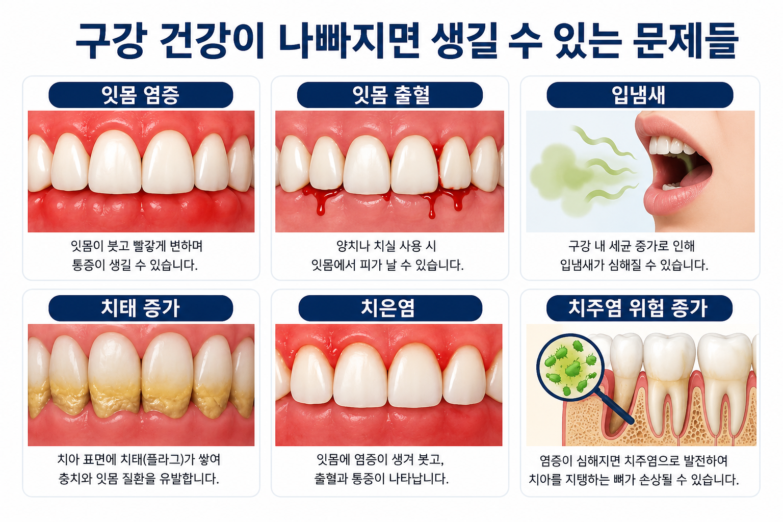 구강 건강이 나빠지면 발생하는 문제들