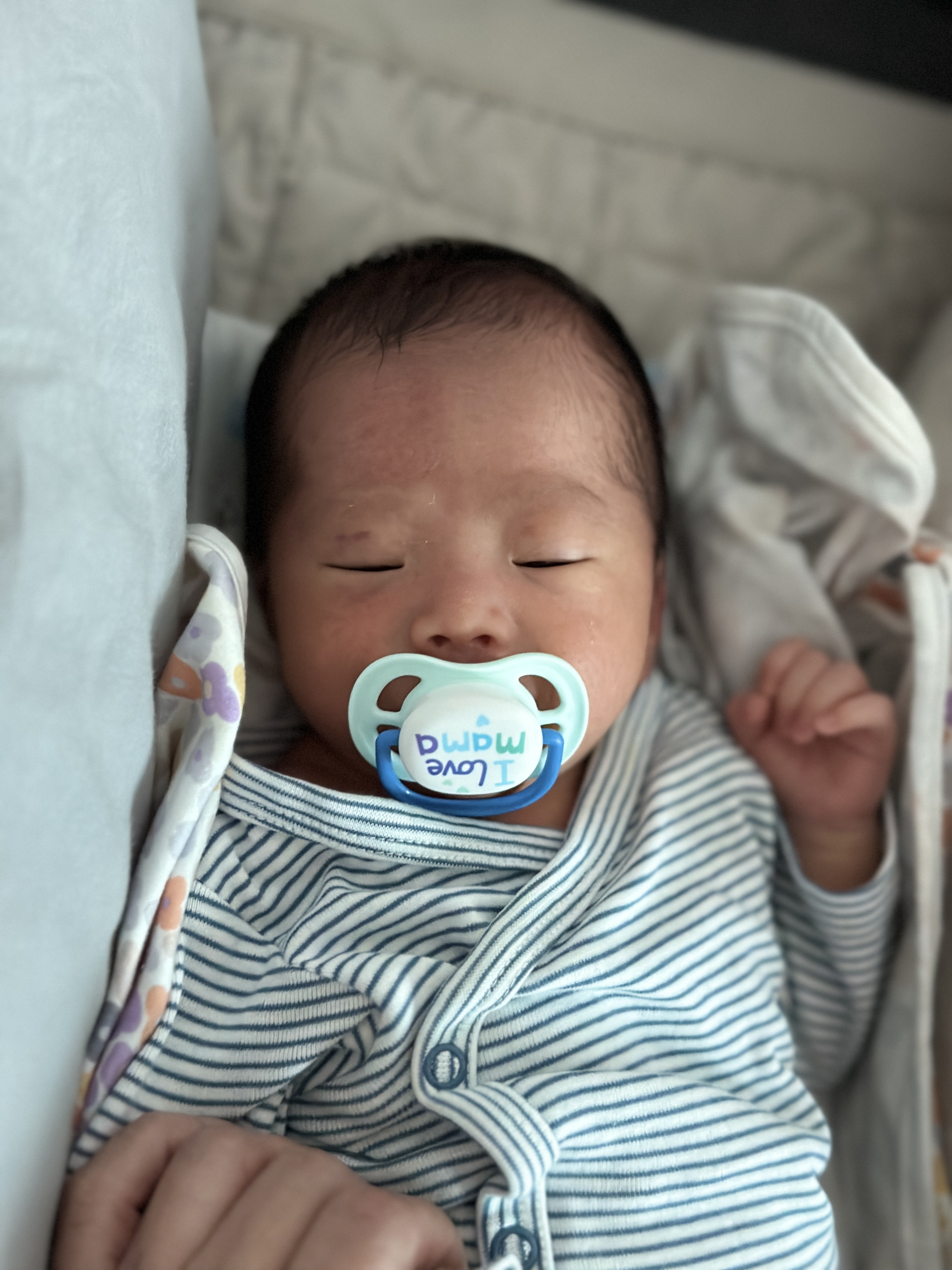 눈에 연어반이 있는 아기 사진