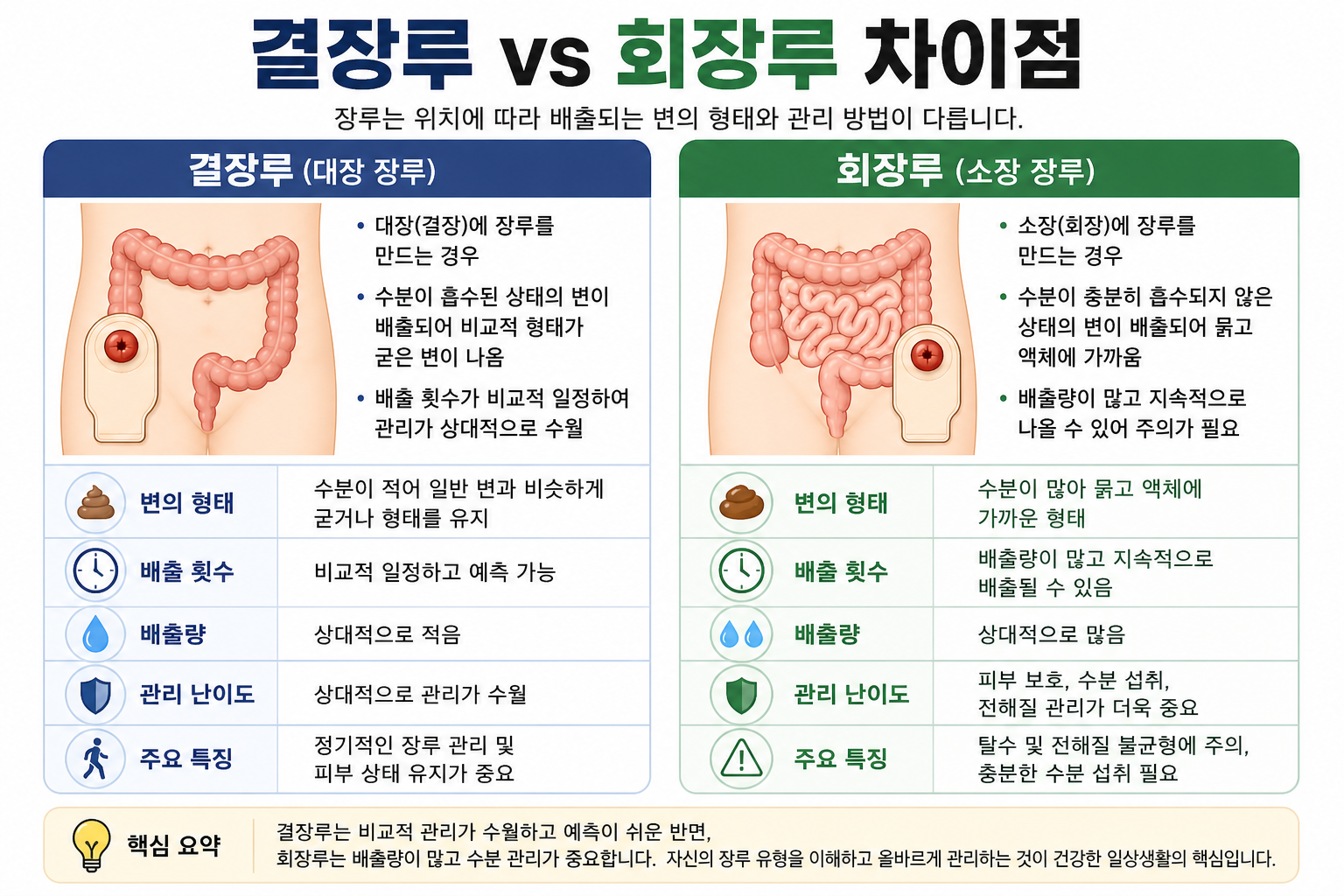 결장루와 회장루의 차이점과 관리 방법을 비교한 장루 인포그래픽 이미지