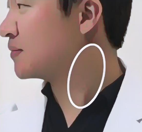 목빗근 위치