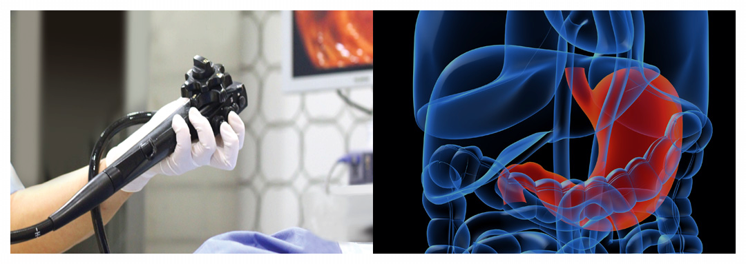 위내시경-금식시간