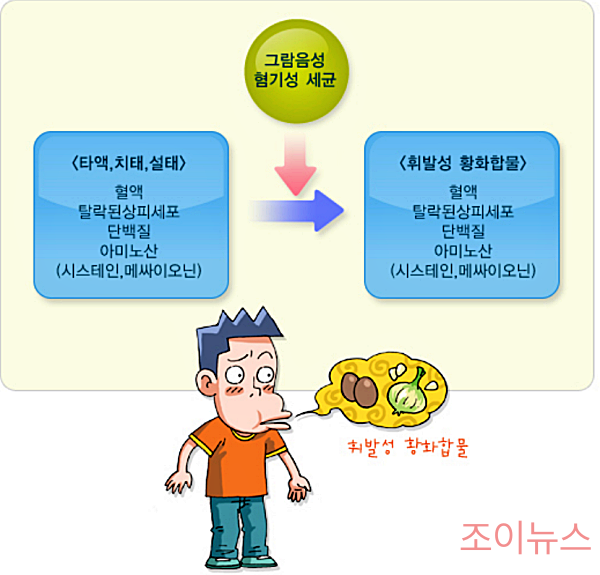 입냄새의 원인_이미지:질병관리청