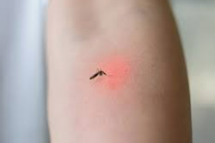 말라리아 증상, 헷갈리지 마세요!