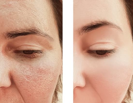 콜라겐(Collagen) : 피부 탄력과 건강의 핵심 단백질