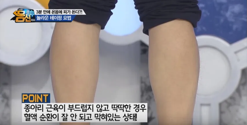 심혈관 질환 예방