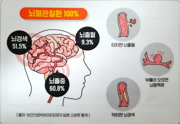 뇌경색