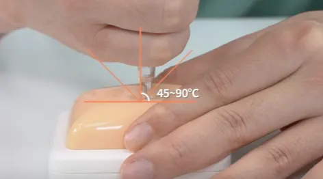 피하주사 방법으로 피부를 잡고 피하층에 45도에서 90도로 주사하는 모습