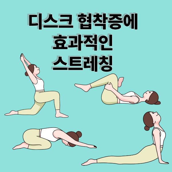 디스크 협착증에 효과적인 스트레칭법