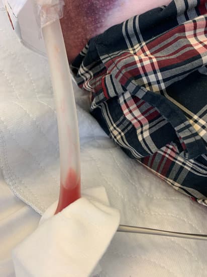 혈흉 및 기흉 배액술 (Thoracostomy for Hemothorax and Pneumothorax)