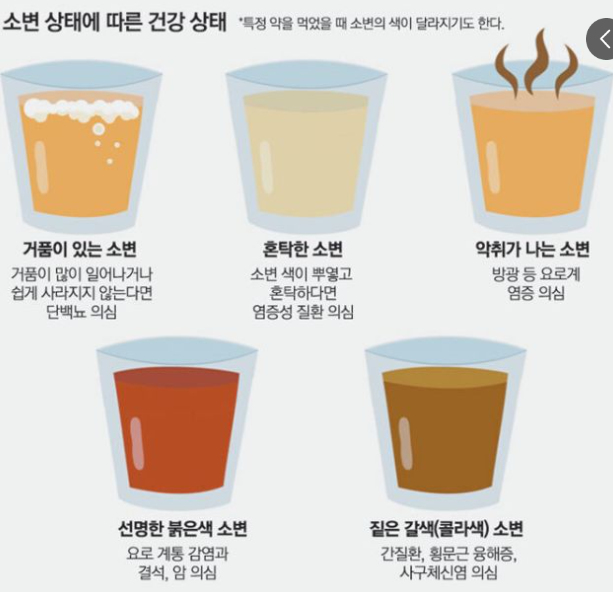 소변색깔로 보는 건강/출처:국민건강