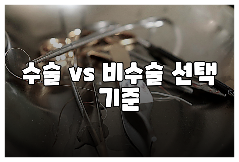 수술 vs 비수술 선택 기준