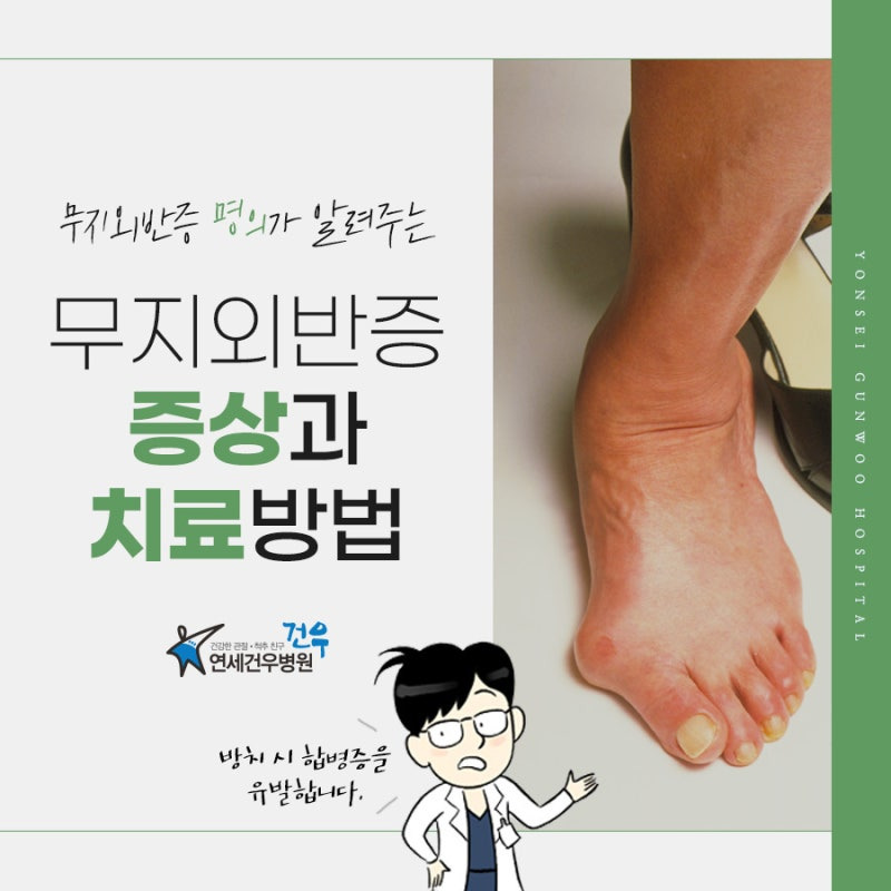 엄지발가락 통증인 무지외반증의 증상과 치료방법