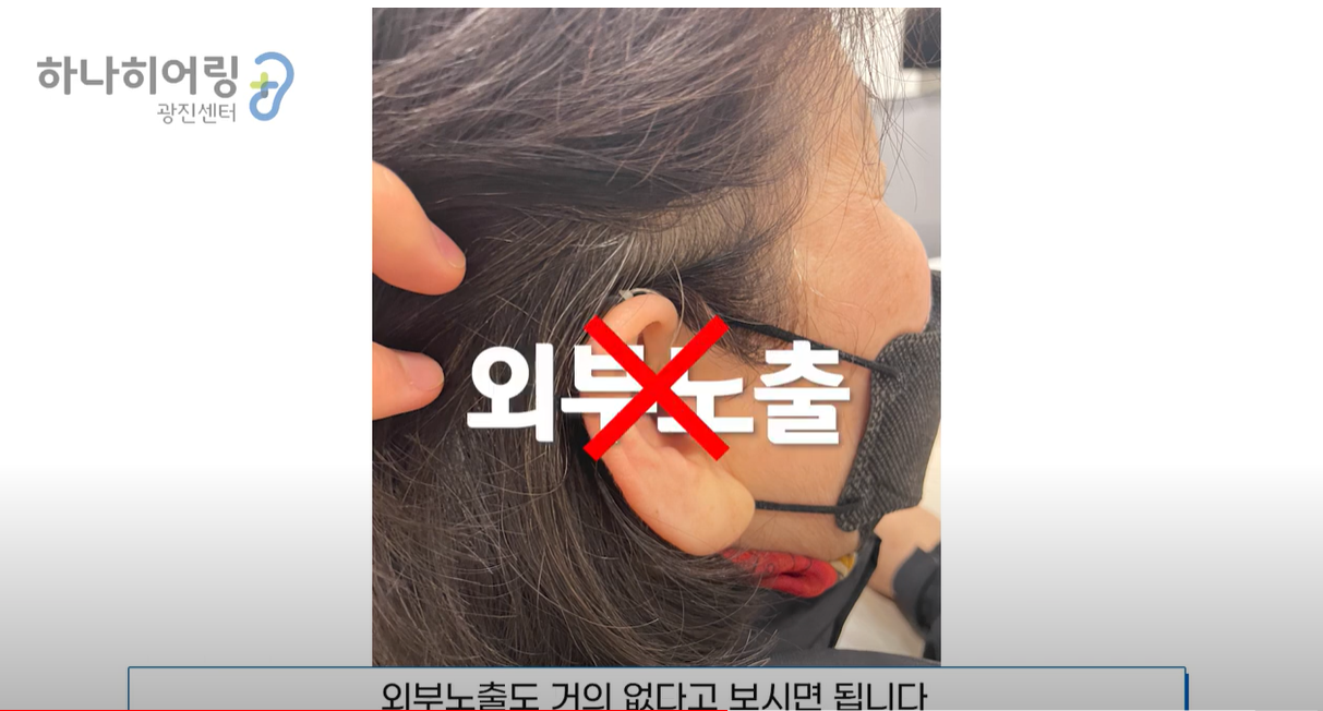 여성분의 경우 외부 노출이 거의 없다