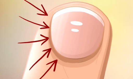 손톱에 세로줄이 생기는 이유