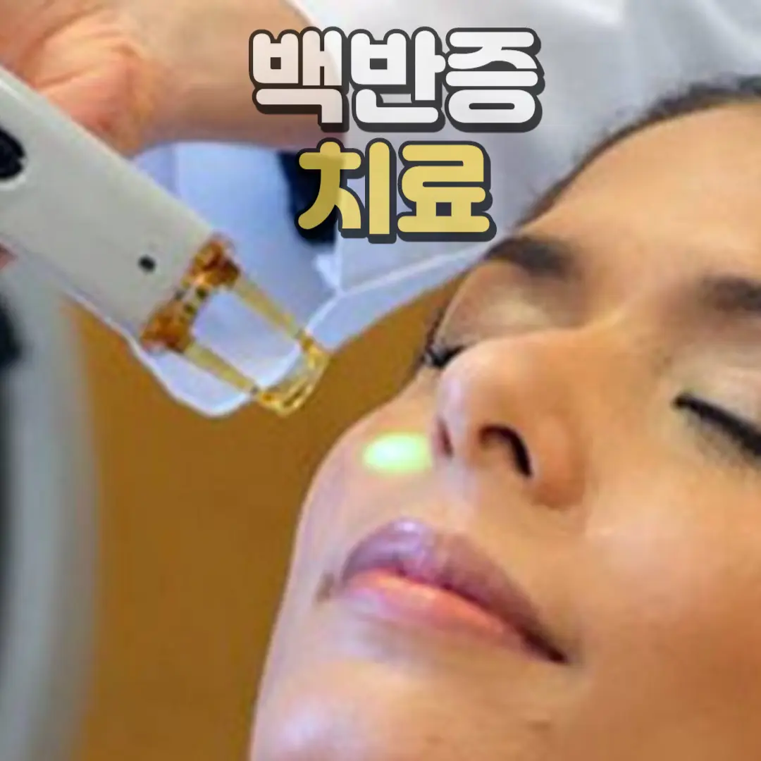 백반증치료
