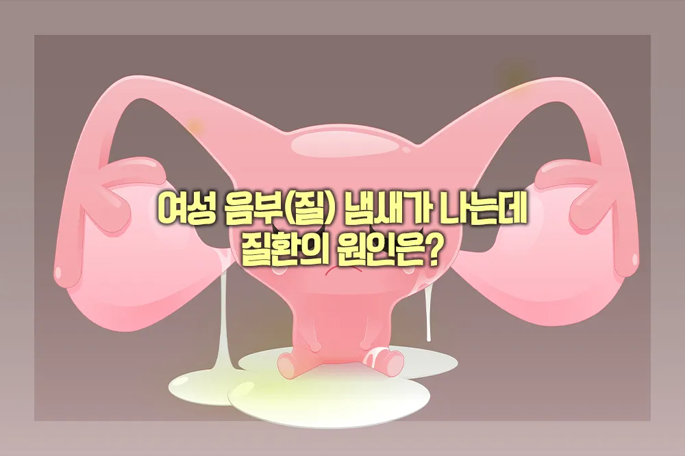 여성 음부 질 냄새 원인