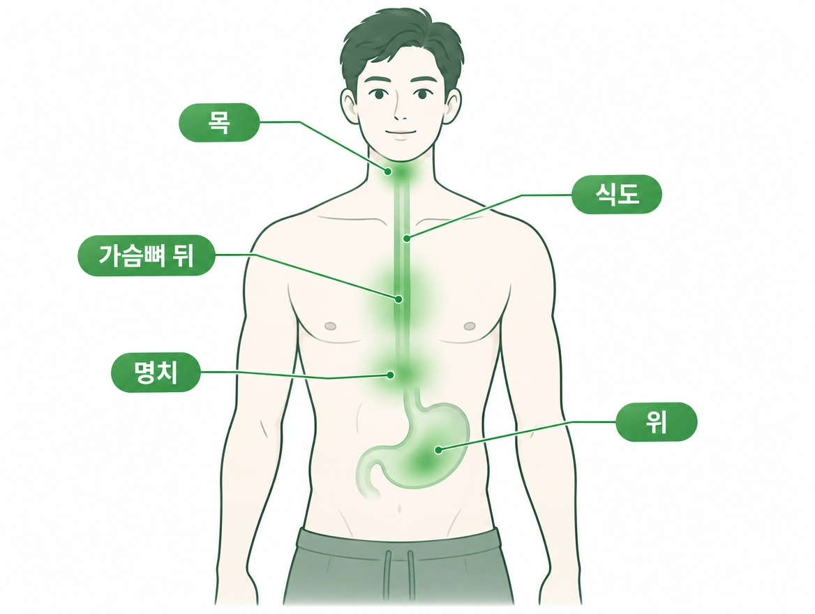 역류성 식도염 증상 위치 비교