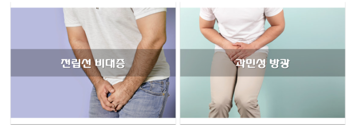 유로파서방정-효능사진