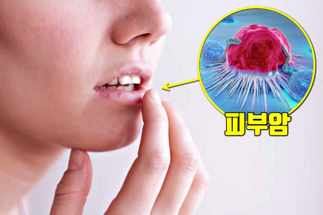 입술 선스틱 선크림 썬크림 추천,눈시림 없는 선크림 피부암,팁줌 매일꿀정보