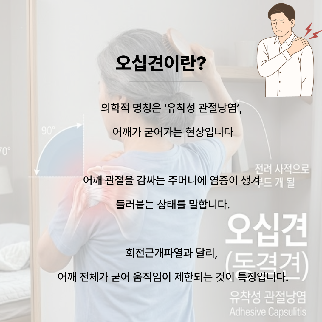 어깨 관절 내부 유착성 관절낭염을 보여주는 해부학적 일러스트와 어깨가 굳어 머리를 빗기 힘들어하는 여성